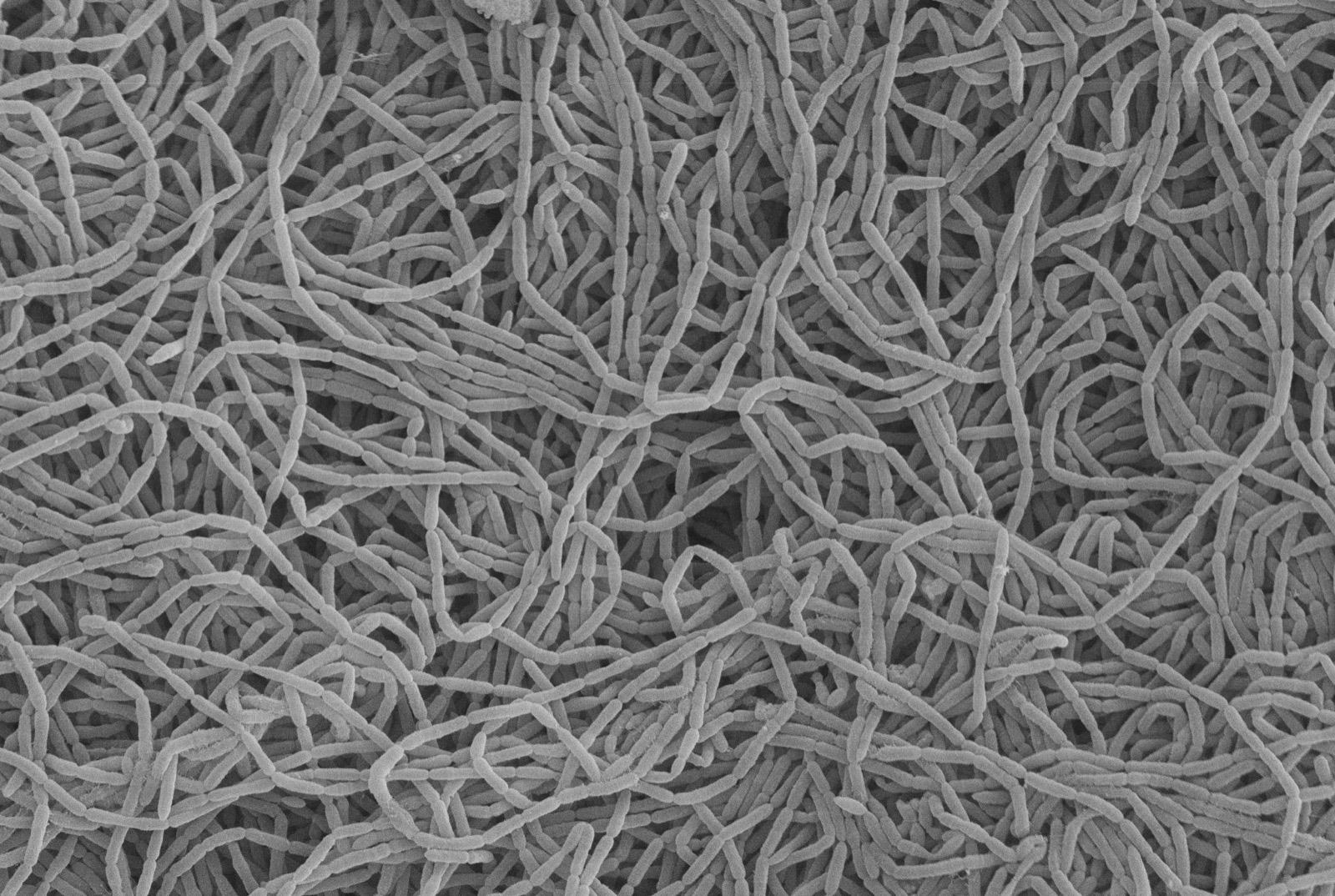 Scanning electron micrograph of isolate NL0064, Clostridium scindens, at 10,000-fold magnification